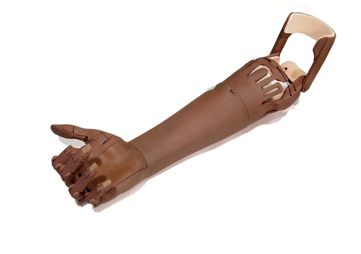 TrueLimb - Next-Generation Prosthetic Arm